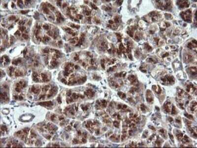 Immunohistochemistry: VTI1A Antibody (OTI1F4) - Azide and BSA Free [NBP2-74862]
