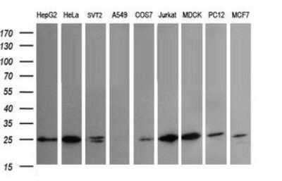 Western Blot: VTI1A Antibody (OTI1F4)Azide and BSA Free [NBP2-74862]