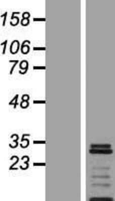 Western Blot: VTI1A Overexpression Lysate [NBP2-05485]