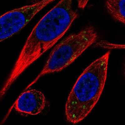 Immunocytochemistry/ Immunofluorescence: VTI1B Antibody [NBP2-56337]