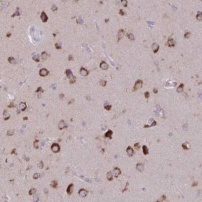 Immunohistochemistry: VTI1B Antibody [NBP2-38886]