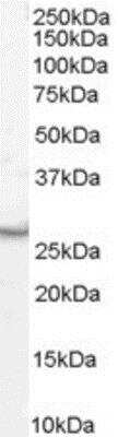 Western Blot: VTI1B Antibody [NB100-2835]