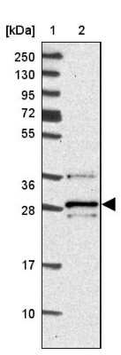 Western Blot: VTI1B Antibody [NBP2-33414]