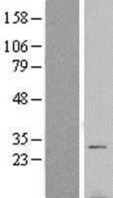 Western Blot: VTI1B Overexpression Lysate [NBL1-17769]