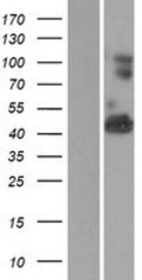 Western Blot: WARP/VWA1 Overexpression Lysate [NBP2-06399]