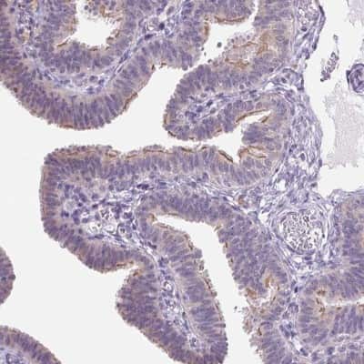 Immunohistochemistry: VWA3B Antibody [NBP2-38320]