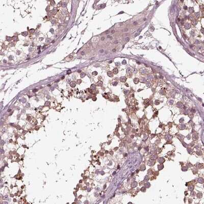 Immunohistochemistry-Paraffin: VWA5B1 Antibody [NBP2-57637]