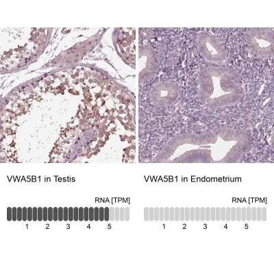 Immunohistochemistry-Paraffin: VWA5B1 Antibody [NBP2-57637]