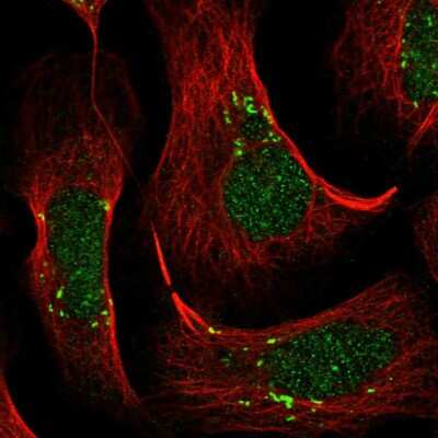 Immunocytochemistry/ Immunofluorescence: VWA5B2 Antibody [NBP1-90500]