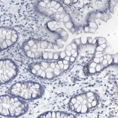 Immunohistochemistry-Paraffin: VWA5B2 Antibody [NBP2-38334]