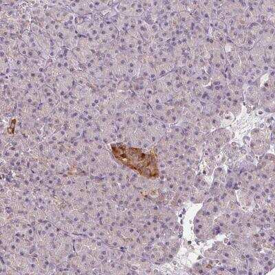 Immunohistochemistry-Paraffin: VWA5B2 Antibody [NBP2-38918]