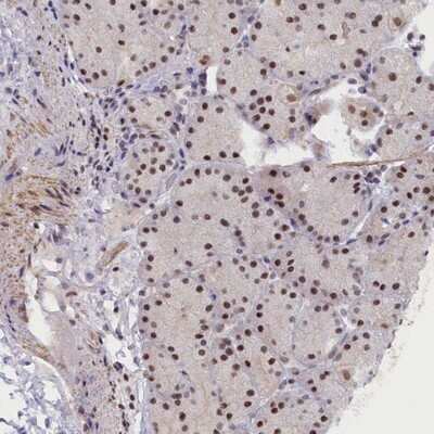 Immunohistochemistry-Paraffin: VWA9 Antibody [NBP1-90524]