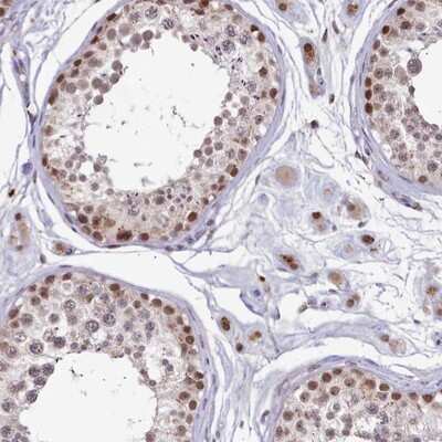 Immunohistochemistry-Paraffin: VWA9 Antibody [NBP1-90525]