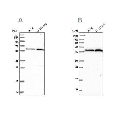 Western Blot: VWA9 Antibody [NBP1-90525]