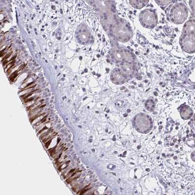 Immunohistochemistry-Paraffin: Brorin/VWC2 Antibody [NBP2-33745]
