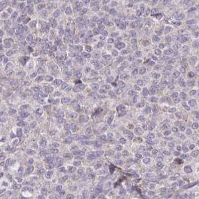 Immunohistochemistry-Paraffin: Brorin/VWC2 Antibody [NBP2-33745]