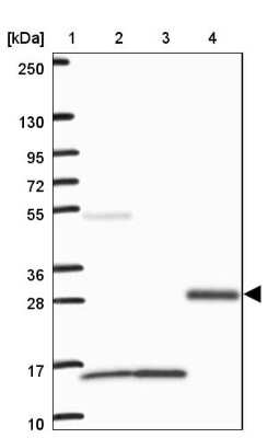 Western Blot: Brorin/VWC2 Antibody [NBP2-33745]