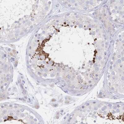 Immunohistochemistry: VWC2L Antibody [NBP2-32456]
