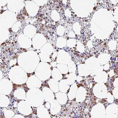 Immunohistochemistry-Paraffin: VWC2L Antibody [NBP1-94166]