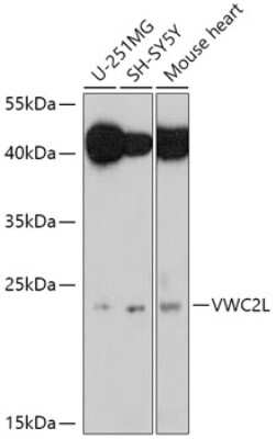 Western Blot: VWC2L AntibodyAzide and BSA Free [NBP3-04346]