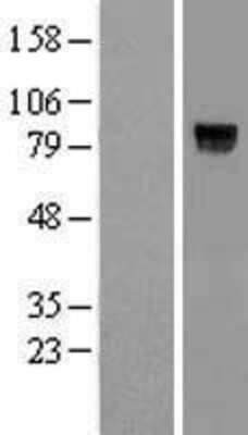 Western Blot: VWC2L Overexpression Lysate [NBP2-08398]