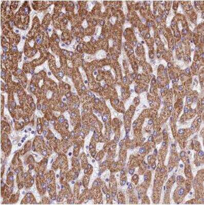 Immunohistochemistry: VWCE Antibody [NBP2-30504]