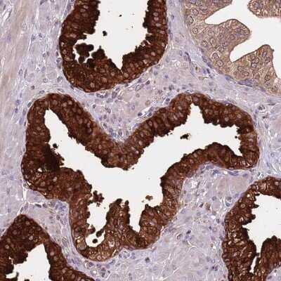 Immunohistochemistry-Paraffin: VWCE Antibody [NBP2-30467]