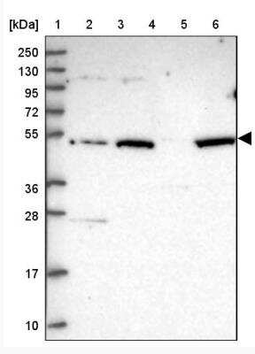 Western Blot: VWCE Antibody [NBP2-30467]