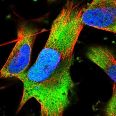 Immunocytochemistry/ Immunofluorescence: VWDE Antibody [NBP2-30605]