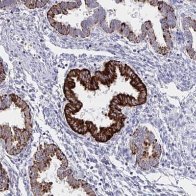 Immunohistochemistry: VWDE Antibody [NBP2-32714]