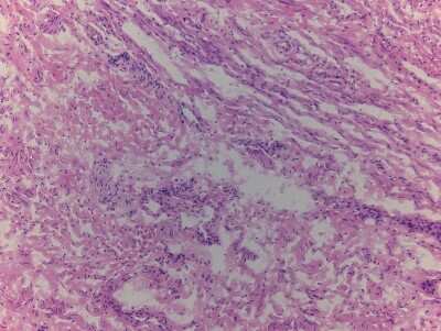 Hematoxylin & Eosin Stain: Vagina Tissue Slides (Adult Normal)- Frozen [NBP2-77560]