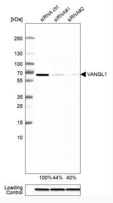 Western Blot: Vang-like Protein 1/VANGL1 Antibody [NBP1-86990]