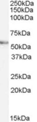 Western Blot: Vang-like Protein 2/VANGL2 Antibody [NB100-59736]