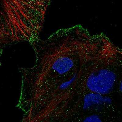 Immunocytochemistry/ Immunofluorescence: Vanilloid R-like 3/TRPV3 Antibody [NBP2-57314]