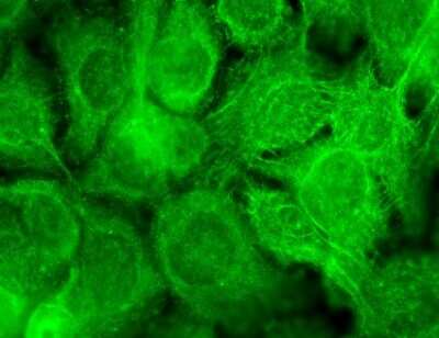 Immunocytochemistry/ Immunofluorescence: Vanilloid R-like 3/TRPV3 Antibody (N15/39) [NBP2-12918]