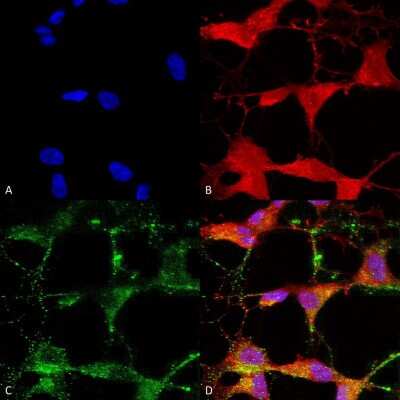 Immunocytochemistry/ Immunofluorescence: Vanilloid R-like 3/TRPV3 Antibody (N15/39) [NBP2-12918]