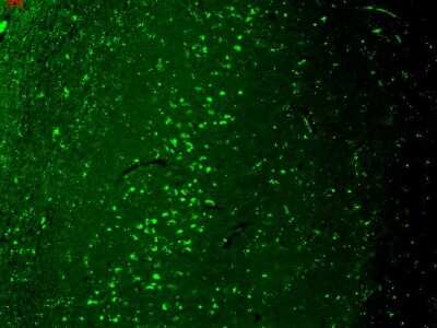 Immunohistochemistry: Vanilloid R-like 3/TRPV3 Antibody (S15/4) [NBP2-12909]