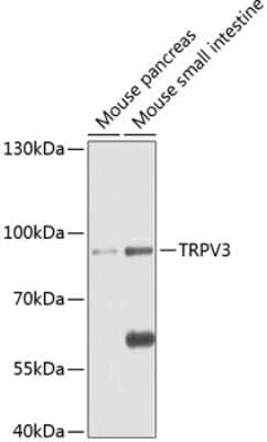 Western Blot: Vanilloid R-like 3/TRPV3 AntibodyBSA Free [NBP3-02993]