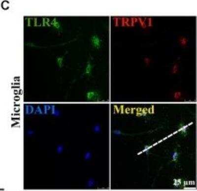 Immunocytochemistry/ Immunofluorescence: Vanilloid R1/TRPV1 Antibody [NB100-98886]