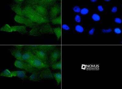 Immunocytochemistry/ Immunofluorescence: Vanilloid R1/TRPV1 Antibody - BSA Free [NBP1-71774]