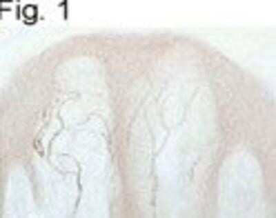 Immunohistochemistry-Frozen: Vanilloid R1/TRPV1 Antibody [NB120-3487]