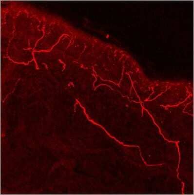 Immunohistochemistry-Frozen: Vanilloid R1/TRPV1 Antibody [NB120-3487]