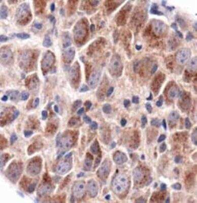 Immunohistochemistry: Vanilloid R1/TRPV1 Antibody - BSA Free [NBP1-71774]