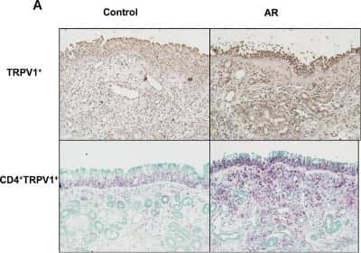 Immunohistochemistry: Vanilloid R1/TRPV1 Antibody - BSA Free [NBP1-71774]