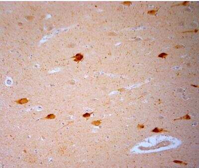 Immunohistochemistry-Paraffin: Vanilloid R1/TRPV1 Antibody [NB100-98886]