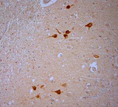 Immunohistochemistry-Paraffin: Vanilloid R1/TRPV1 Antibody [NB100-98886]