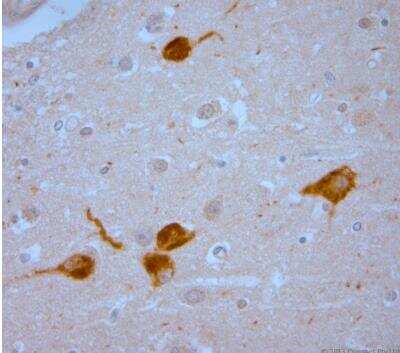 Immunohistochemistry-Paraffin: Vanilloid R1/TRPV1 Antibody [NB100-98886]