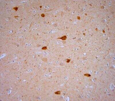 Immunohistochemistry-Paraffin: Vanilloid R1/TRPV1 Antibody [NB100-98886]