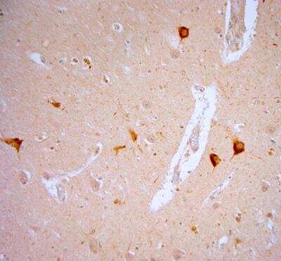 Immunohistochemistry-Paraffin: Vanilloid R1/TRPV1 Antibody [NB100-98886]
