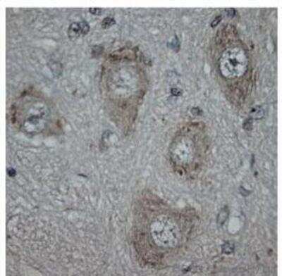 Immunohistochemistry-Paraffin: Vanilloid R1/TRPV1 Antibody [NB100-98897]
